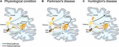 On the Right Track to Treat Movement Disorders: Promising Therapeutic Approaches for Parkinson’s and Huntington’s Disease